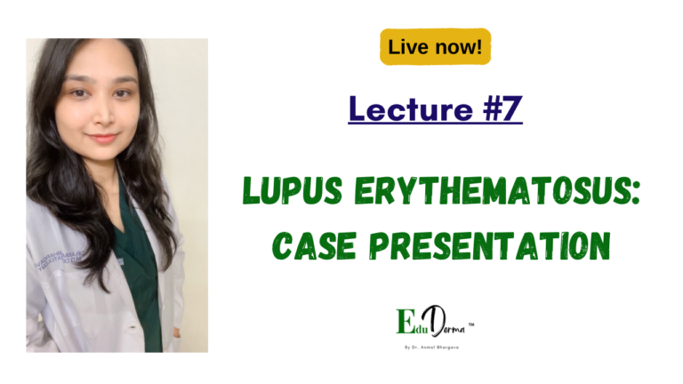 Lecture 7: Case Presentation – Lupus Erythematosus